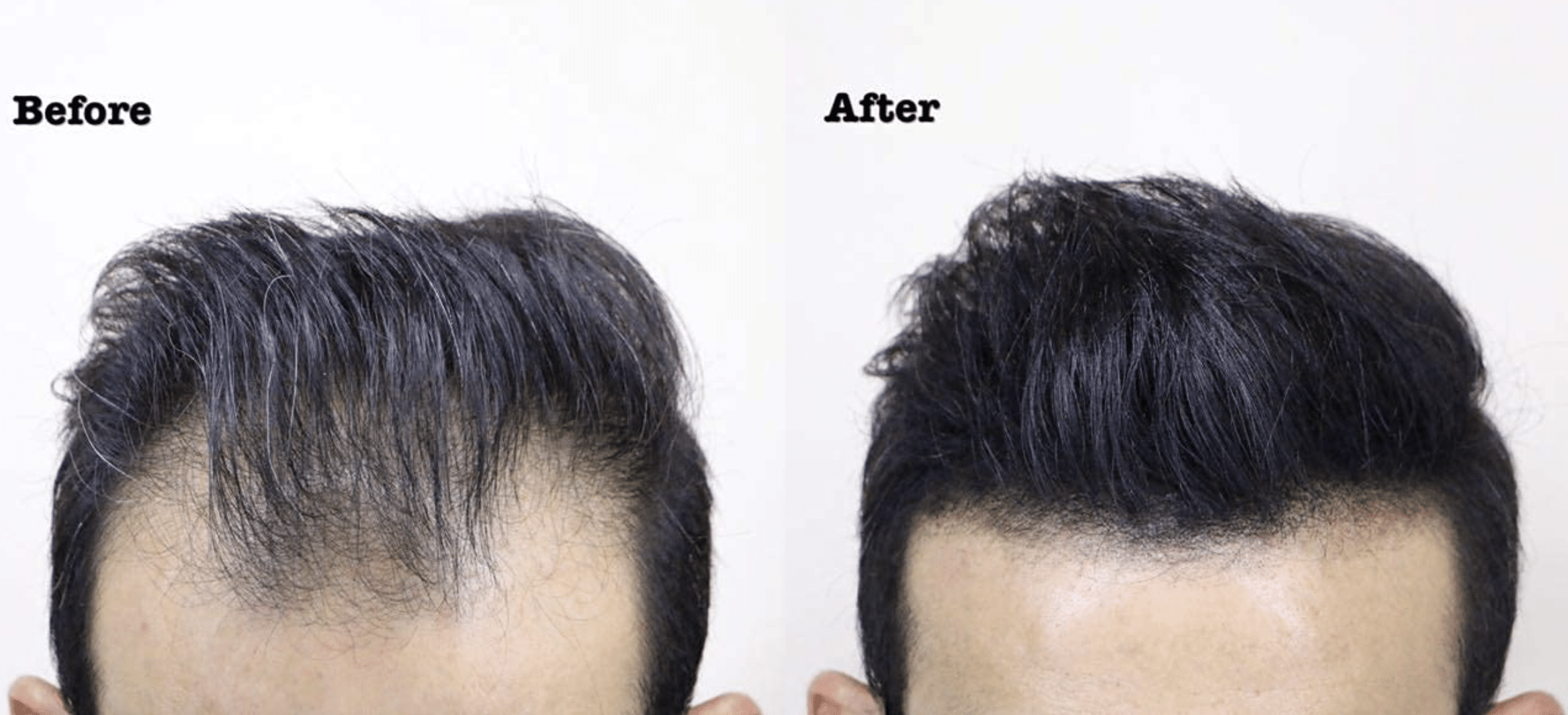 Was ist der Zweck der Haarfaser?