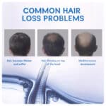 Hair Growth Mousse640