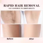 Hair Removal Spray00985