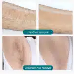 Hair removal spray 6064