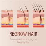 Hair growth essential oil1008