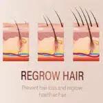 Hair growth essential oil1008