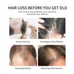 Hair growth spray (3)