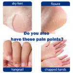 Cream Wax Skin Care for Dry Skin6
