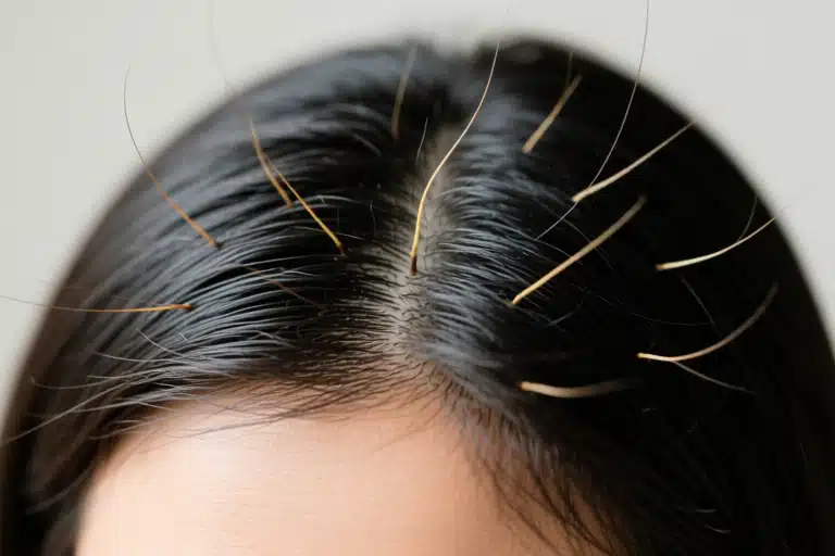 how much does hair grow in a month2